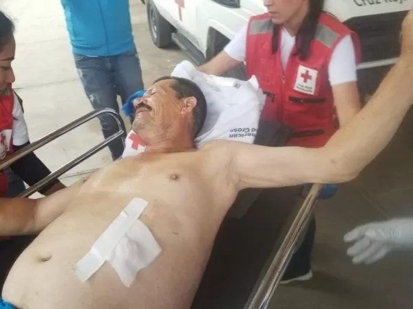 Gravemente herido resulta ciudadano tras recibir varios impactos de bala en La Entrada, Copán