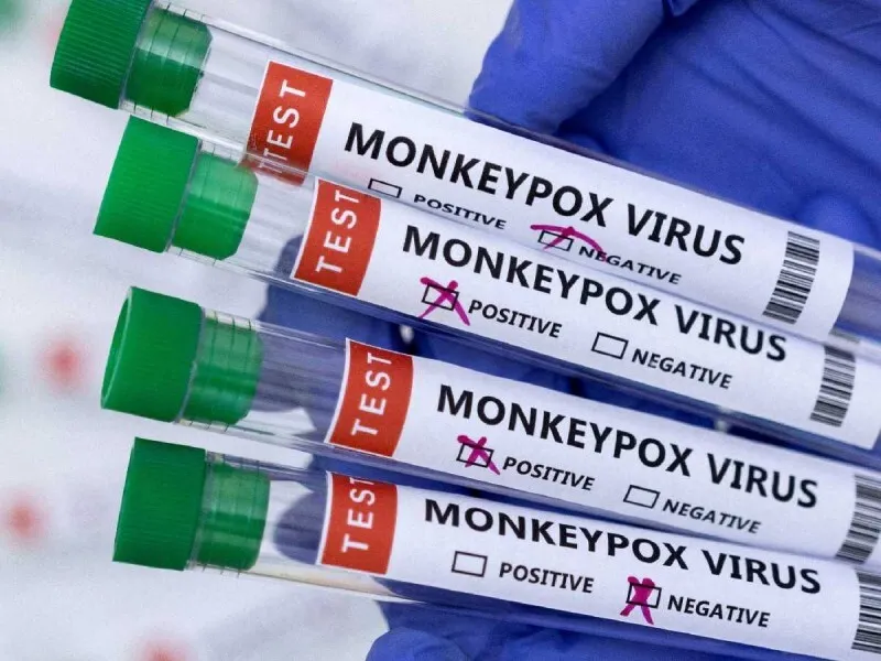 La viruela del mono ha sido declarada una emergencia internacional por la OMS y estos son los síntomas