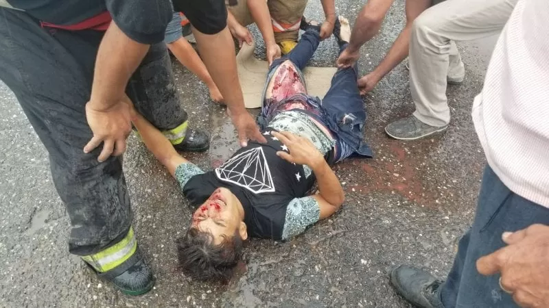 Motociclista resulta con heridas graves tras accidente en Macuelizo, Santa Bárbara