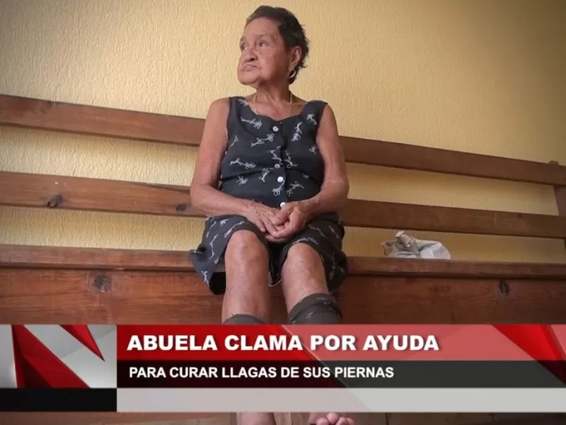 VIDEO: Abuela clama por ayuda para curar llagas en sus pies