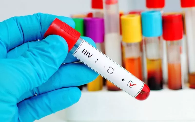 Científicos dan un paso alentador hacia una vacuna del VIH