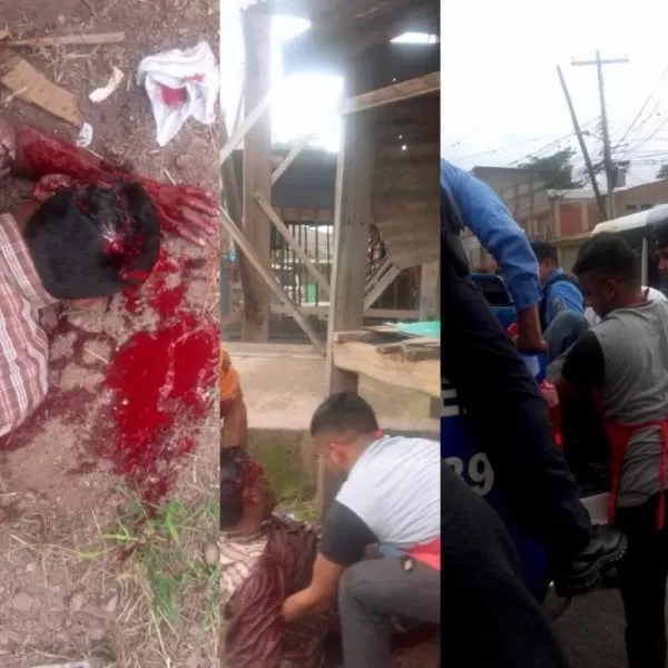 VIDEO: Desconocidos atacan a un hombre en la Colonia La Esperanza