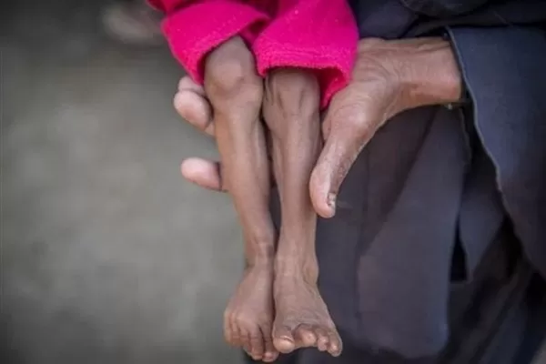 Guerra en Yemen: 85.000 niños han muerto de hambre