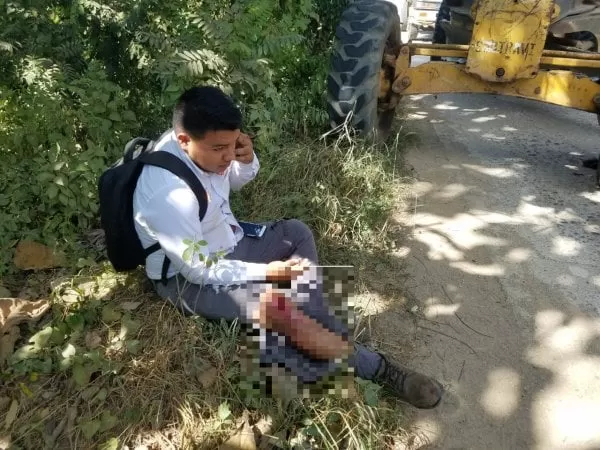 Un joven herido deja accidente en Quimistán, Santa Bárbara 