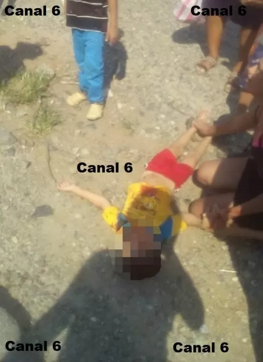Menor muere tras ser atropellado en el sector de Cofradía 