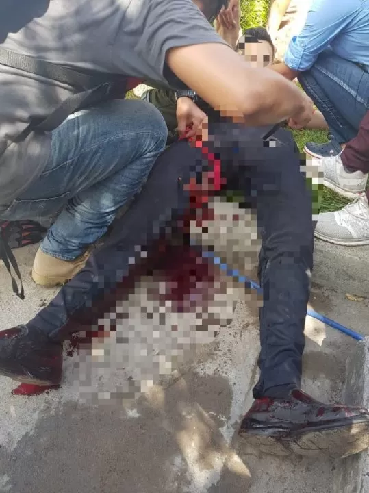 Un joven herido deja enfrentamiento entre manifestantes y policías en Choluteca 