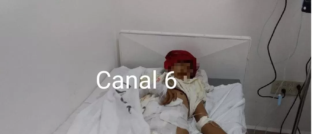 En estado grave se encuentra jovencito de 14 años alcanzado por un rayo en Choluteca (Video)