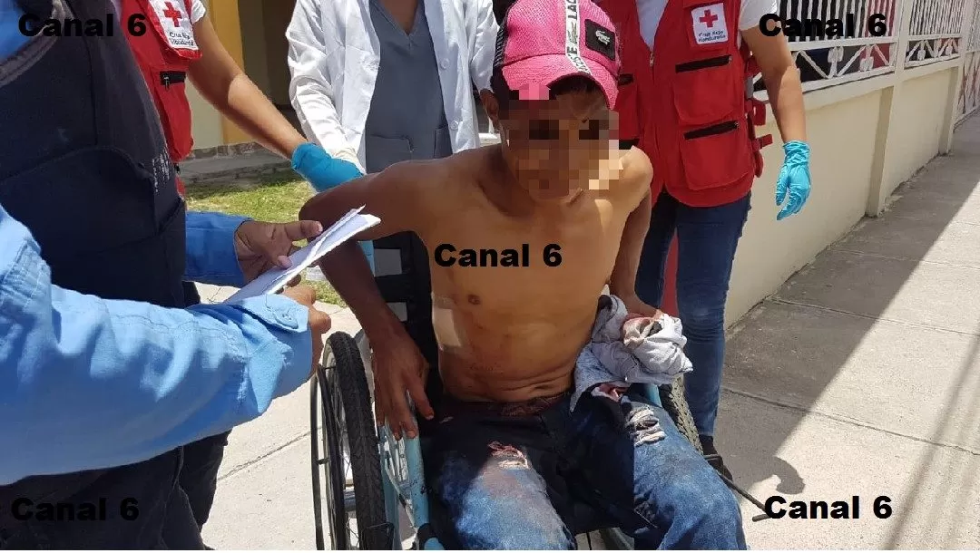 Intentan asesinar a joven en la comunidad de San Pablo, El Roble, Nueva Arcadia, Copán