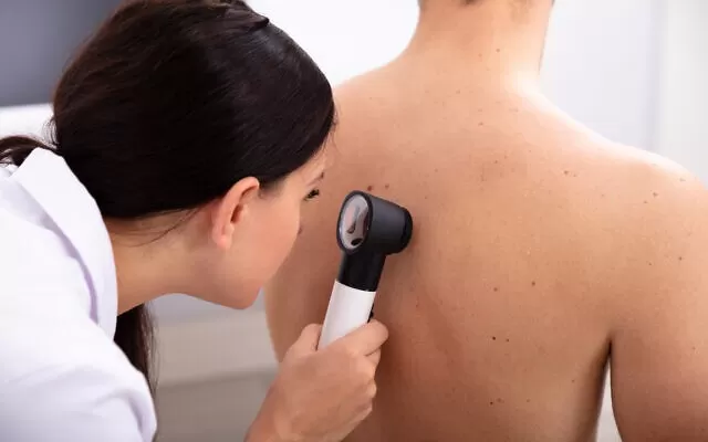 Nueva tecnología israelí permitirá diagnosticar melanomas y otros tipos de cánceres de piel en 10 segundos