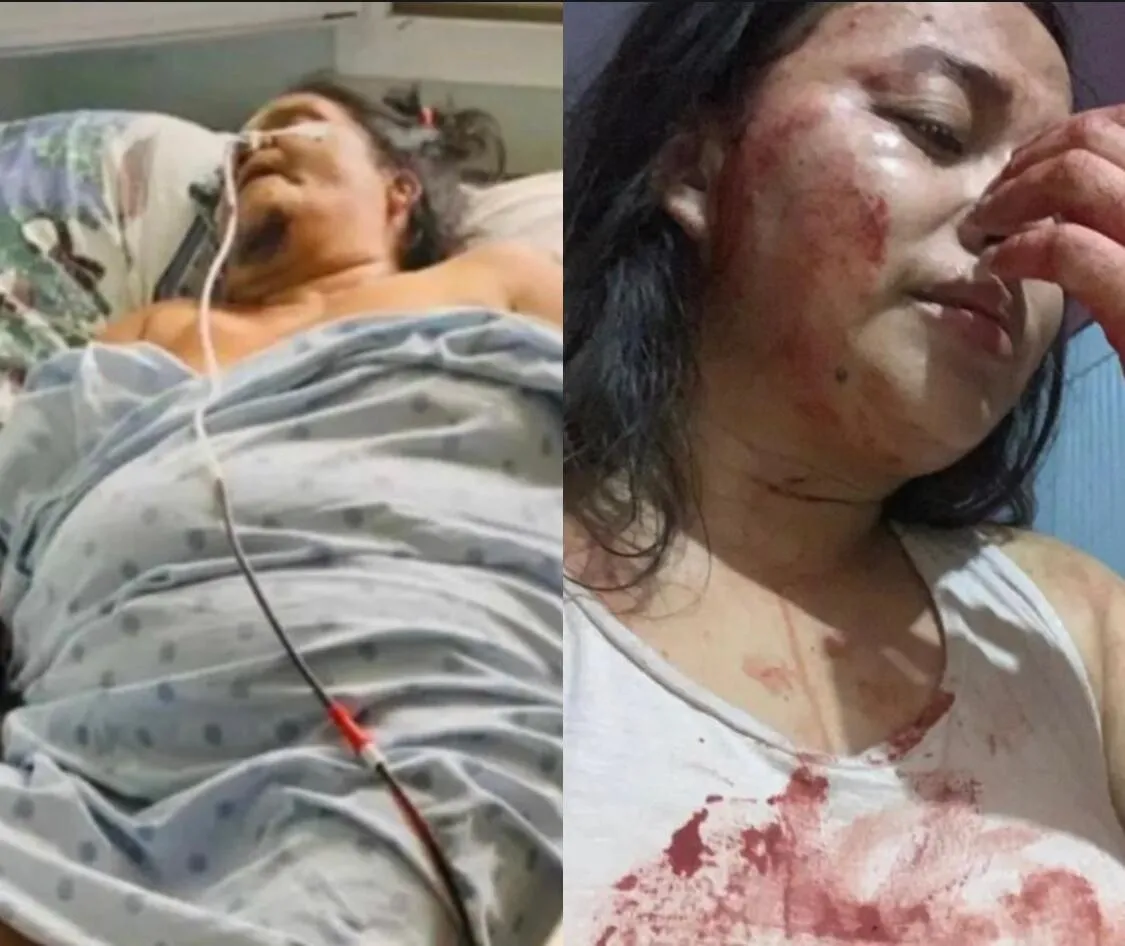 Hondureña denuncia que su expareja intentó asesinarla con un machete a ella y a su madre