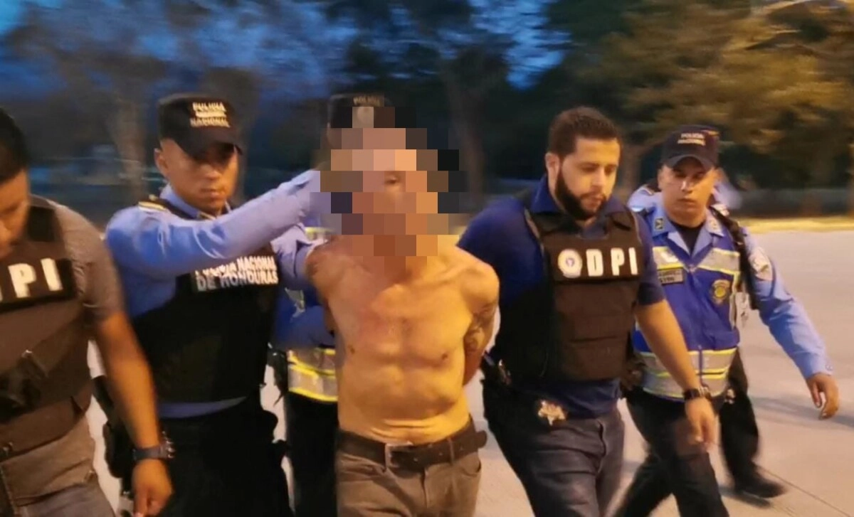 Arrestan a sujeto tras herir de gravedad a oficial de la policía
